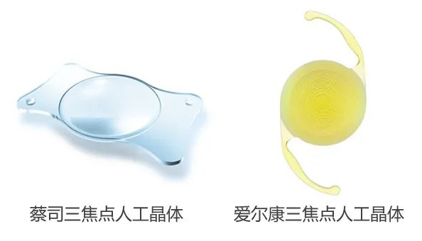 三焦點(diǎn)人工晶體