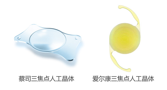 白內(nèi)障手術